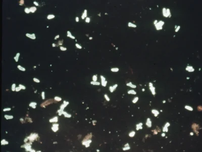 Rhizobium-bacteroids-with-a-few-undifferentiated-entiated-cells_LR
